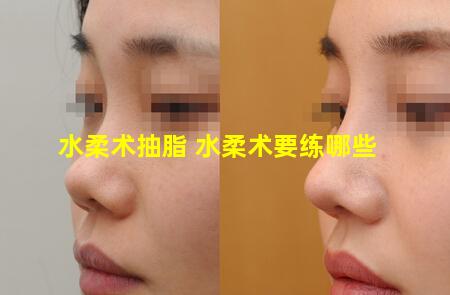 水柔术抽脂 水柔术要练哪些